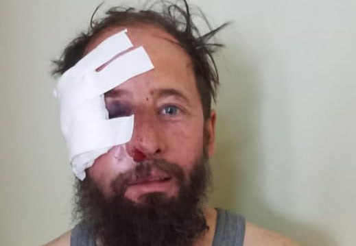 В результате обстрела деоккупированного Берислава ранен священник ПЦУ